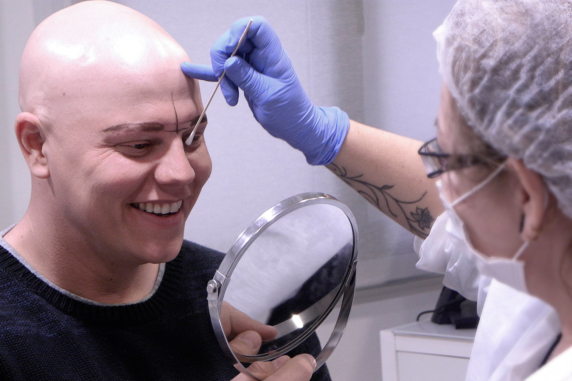 Caso de micropigmentación de cejas en cliente con alopecia universal