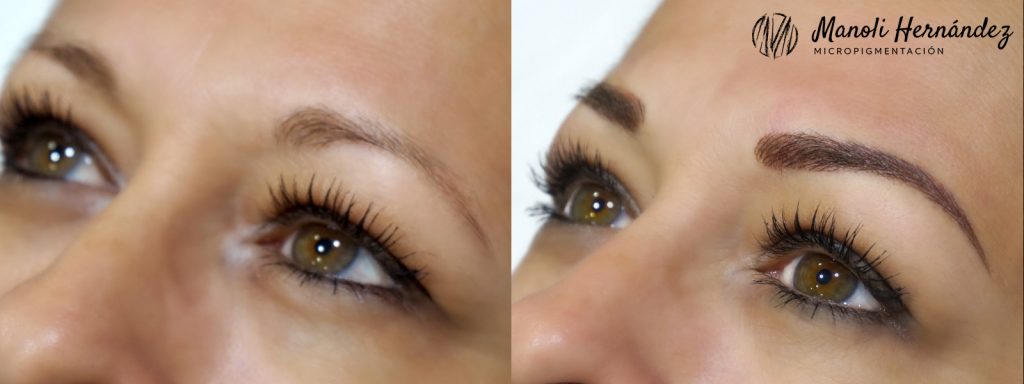 Antes y después de un tratamiento de micropigmentación facial en cejas