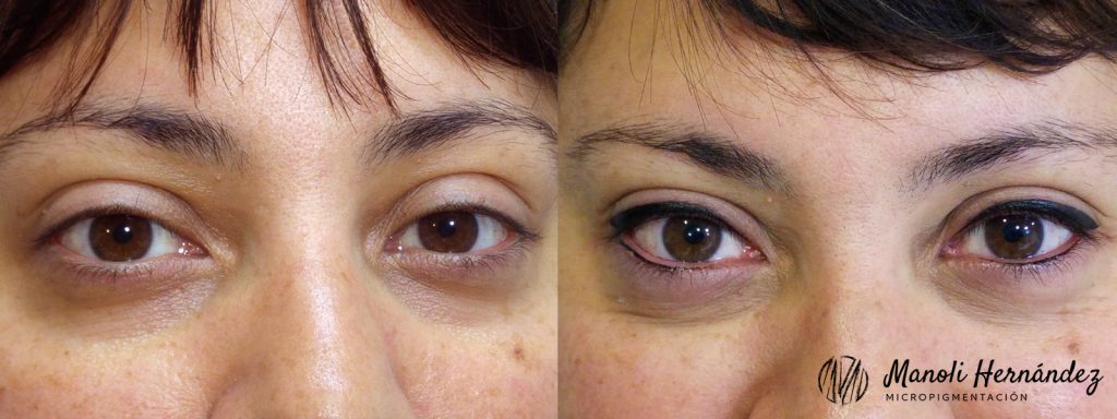 Antes y después de un tratamiento de micropigmentación facial en ojos (eyeliner superior e inferior)