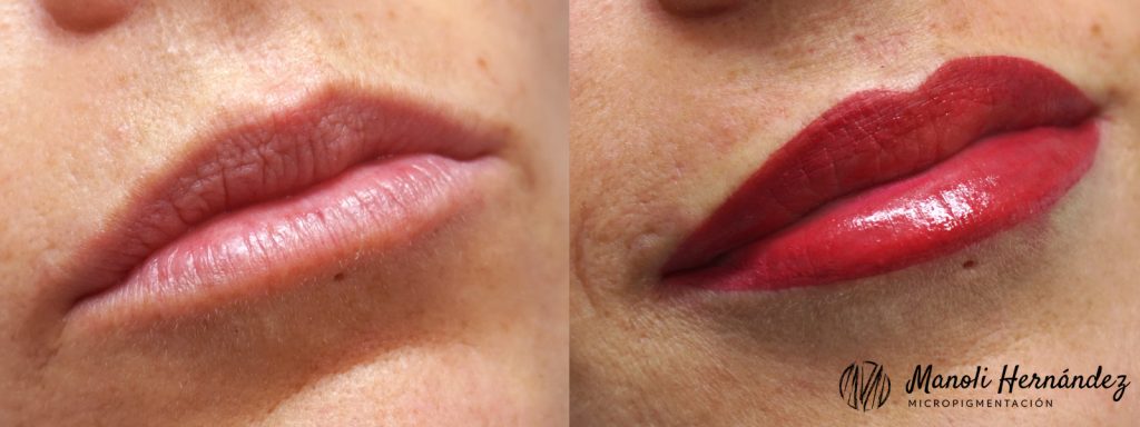 Antes y después de un tratamiento de micropigmentación facial en labios