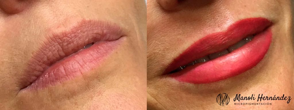 Antes y después de un tratamiento de micropigmentación facial en labios