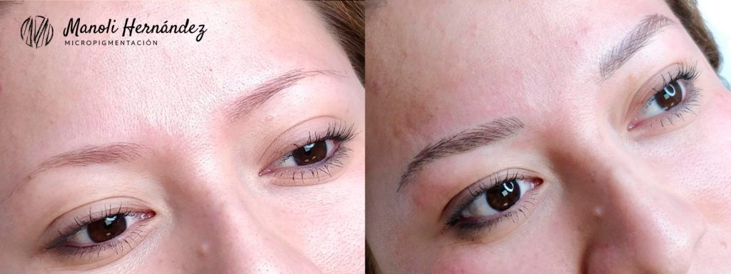 Antes y después de un tratamiento de micropigmentación facial en cejas
